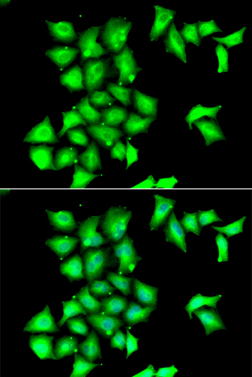 Immunofluorescence analysis of HeLa cells using MSRB1 antibody 