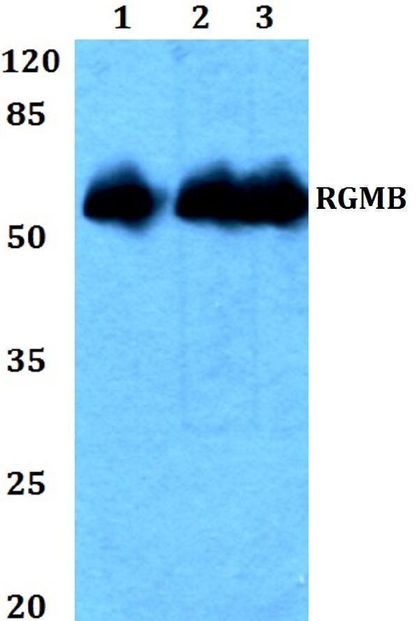 Western blot (WB) analysis of RGMB polyclonal antibody at 1:500 dilution
Lane1:HEK293T whole cell lysate
Lane2:NIH-3T3 whole cell lysate
Lane3:H9C2 whole cell lysate