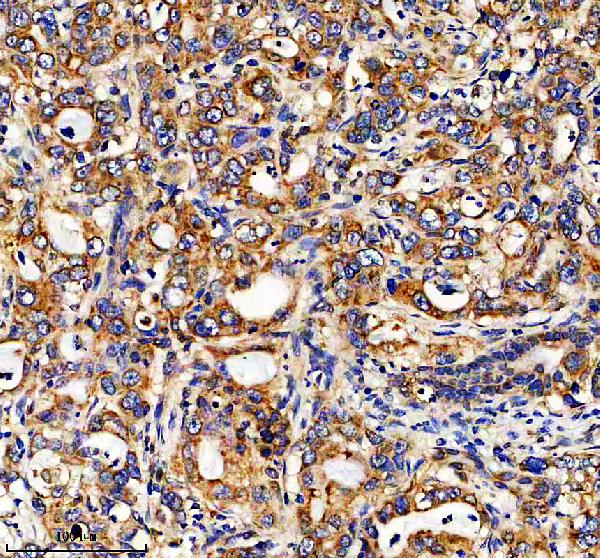 IHC analysis of SEC24D using anti-SEC24D antibody (A06985-1)
