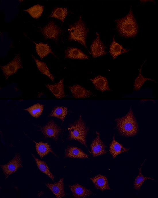 Immunofluorescence analysis of L929 using CPT1C antibody  at dilution of 1:100