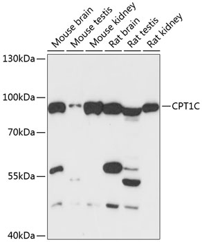 Western blot analysis of extracts of various cell lines, using CPT1C antibody  at 1:3000 dilution