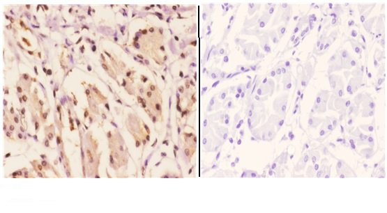 a06990s40 nr2f6 primary antiboties ihc testing 2