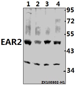 a06990s40 nr2f6 primary antiboties wb testing 1