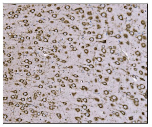 a06993 1 ssr1 primary antibodies ihc testing 6