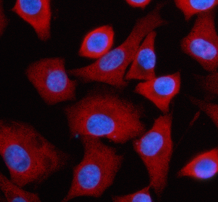 a06994 3 rpl30 primary antibodies if testing 1