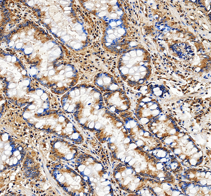 a06994 3 rpl30 primary antibodies ihc testing 1