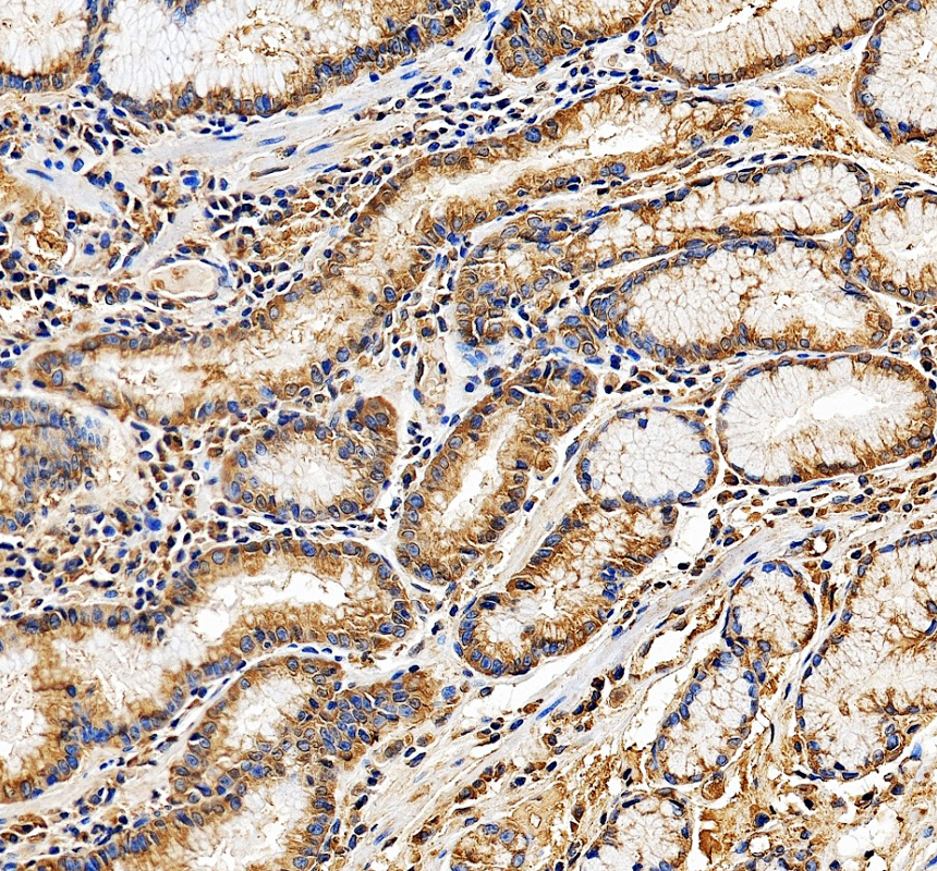 a06994 3 rpl30 primary antibodies ihc testing 2