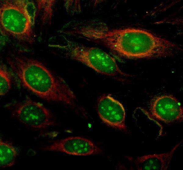 IF analysis of PPHLN1 using anti-PPHLN1 antibody (A06996-3) and anti-Alpha Tubulin antibody (M03989-3)