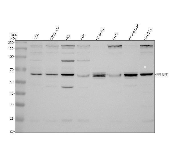 Western blot analysis of PPHLN1 using anti-PPHLN1 antibody (A06996-3)