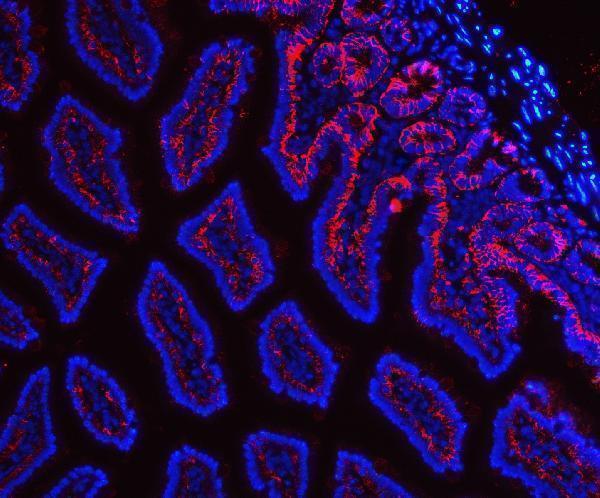 a06997 1 tspan8 primary antibodies if testing 6