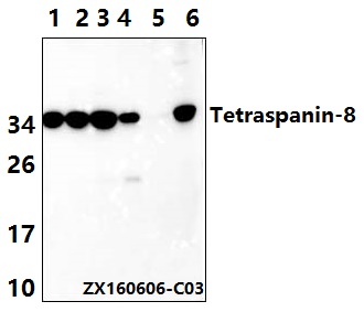 Western blot (WB) analysis of Tetraspanin-8 (S129) polyclonal antibody at 1:500 dillution
Lane1:Hct116 whole cell lysate
Lane2:SGC7901 whole cell lysate
Lane3:DLD whole cell lysate
Lane4:The Kidney tissue lysate of Mouse
Lane5:The Intestines tissue lysate of Rat
Lane6:BV2 whole cell lysate