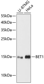 a07000 bet1 primary antiboties wb testing 1