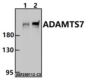 Western blot (WB) analysis of ADAMTS7 polyclonal antibody at 1:1000 dilution
Lane1:A549 whole cell lysate(30ug)
Lane2:EC9706 whole cell lysate(30ug)