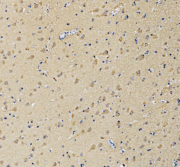 IHC analysis of RPL31 using anti-RPL31 antibody (A07002-2)