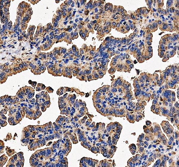 IHC analysis of RPL31 using anti-RPL31 antibody (A07002-2)
