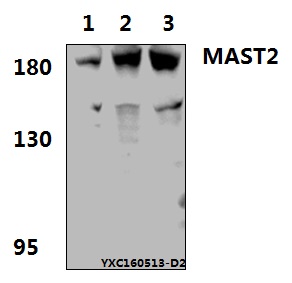 Western blot (WB) analysis of MAST2 polyclonal antibody at 1:500 dillution
Lane1:PC3 treated with PMA(60ng/ml, 30min) whole cell lysate(40μg) 
Lane2:The Testis tissue lysate of Rat (40μg)
Lane3:The Testis tissue lysate of Mouse(40μg)