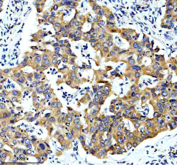 IHC analysis of CYP2C18 using anti-CYP2C18 antibody (A07005-3)