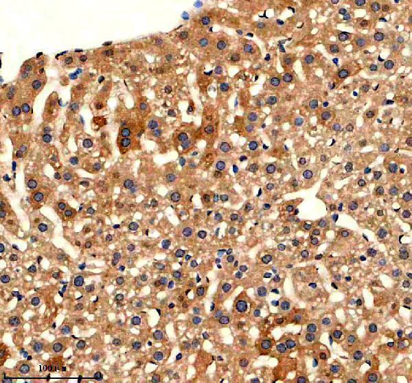 IHC analysis of CYP2C18 using anti-CYP2C18 antibody (A07005-3)