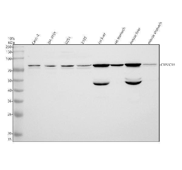 Western blot analysis of CYP2C18 using anti-CYP2C18 antibody (A07005-3)