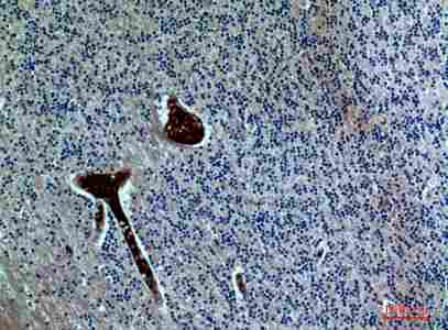 a07009 fgf17 primary antibodyes ihc testing 1