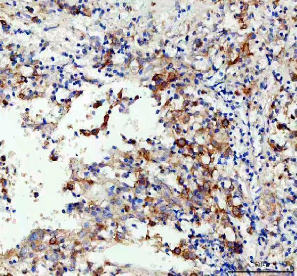 a07010 2 coro1c primary antibodies ihc testing 1