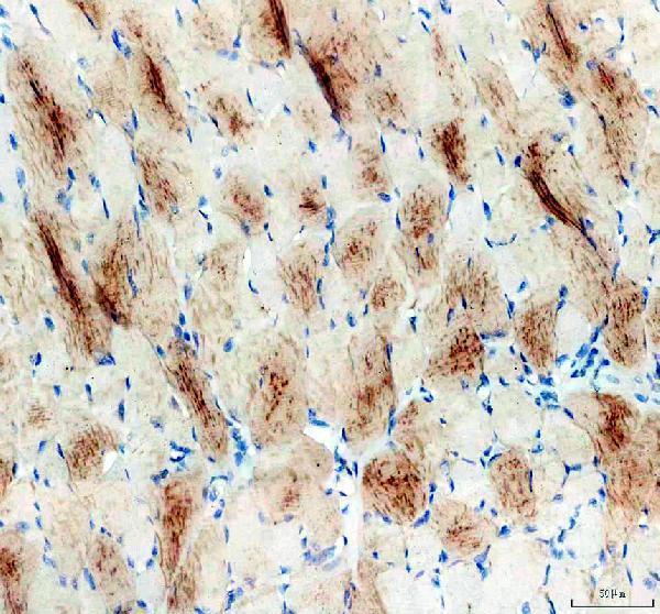 a07010 2 coro1c primary antibodies ihc testing 2_1