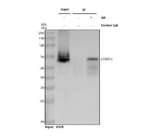 a07010 2 coro1c primary antibodies ip testing 1