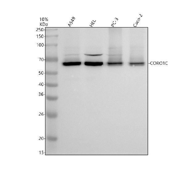 a07010 2 coro1c primary antibodies wb testing 1_1