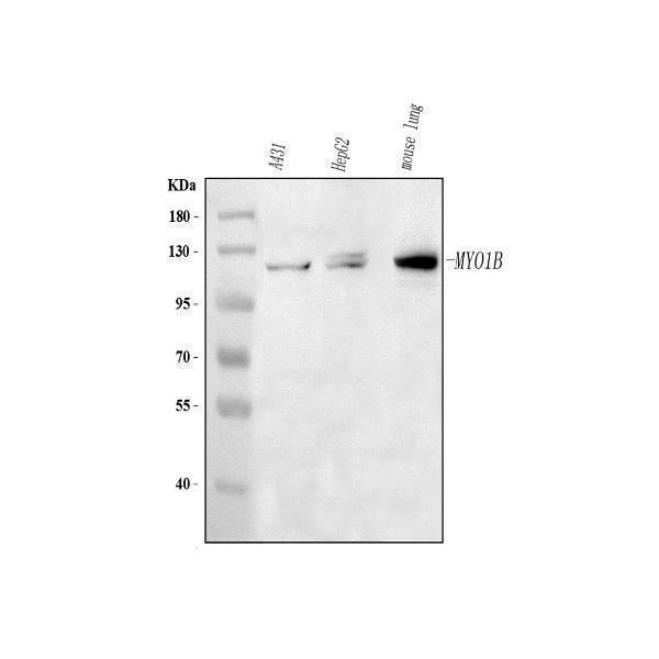  Western blot analysis of MYO1B using anti-MYO1B antibody (A07011-1)