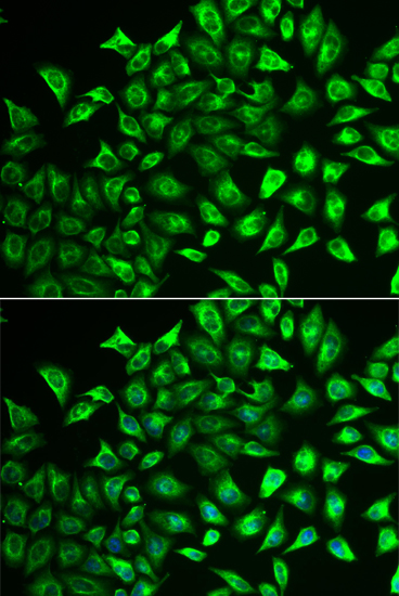 Immunofluorescence analysis of U2OS cells using MMRN1 antibody