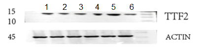  Western blot analysis of TFF2 using anti-TFF2 antibody (A07013-2)