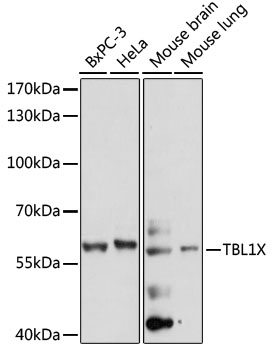 Western blot analysis of extracts of various cell lines, using TBL1X antibody  at 1:1000 dilution