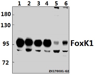 Western blot (WB) analysis of FoxK1 (G698) pAb at 1:500 dilution
Lane1:K562 whole cell lysate(40ug)
Lane2:HCT116 whole cell lysate(40ug)
Lane3:A549 whole cell lysate(40ug)
Lane4:MCF-7 whole cell lysate(40ug)
Lane5:CT26 whole cell lysate(40ug)
Lane6:C6 whole cell lysate(40ug)