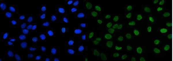 a07015 2 foxk1 primary antibodies if testing 10