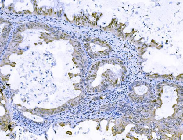 a07015 2 foxk1 primary antibodies ihc testing 3_1