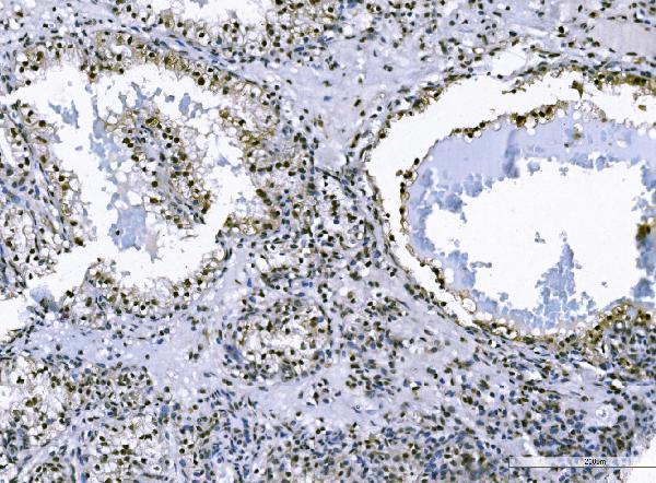 a07015 2 foxk1 primary antibodies ihc testing 4