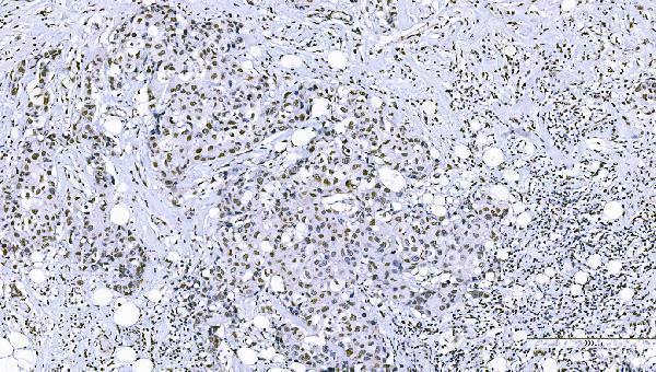 a07015 2 foxk1 primary antibodies ihc testing 5