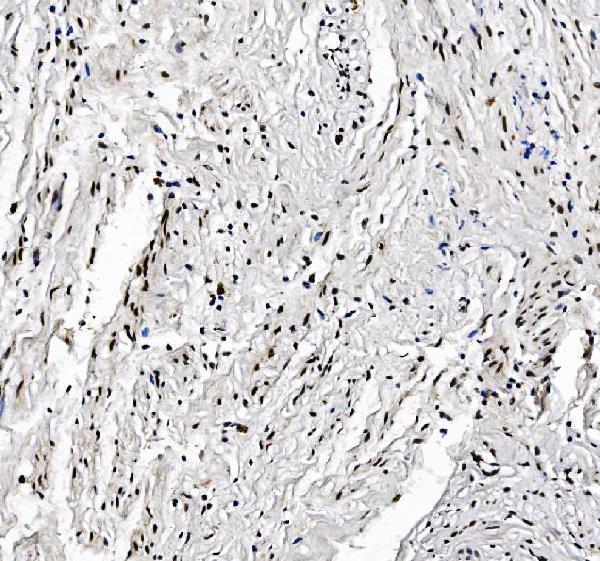a07015 2 foxk1 primary antibodies ihc testing 6