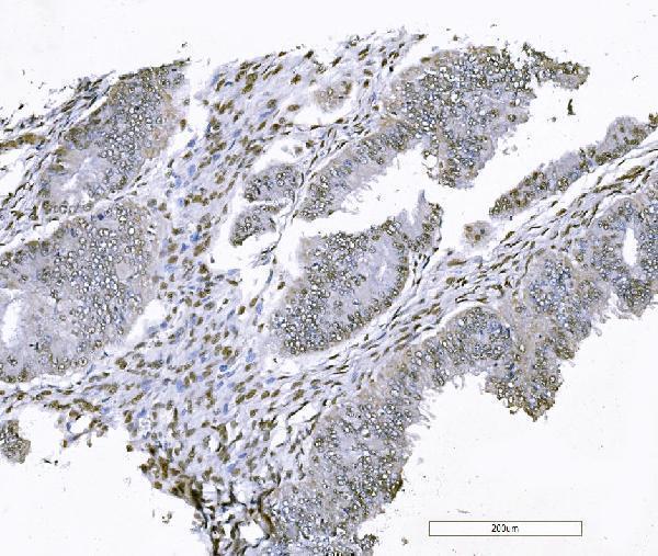 a07015 2 foxk1 primary antibodies ihc testing 7