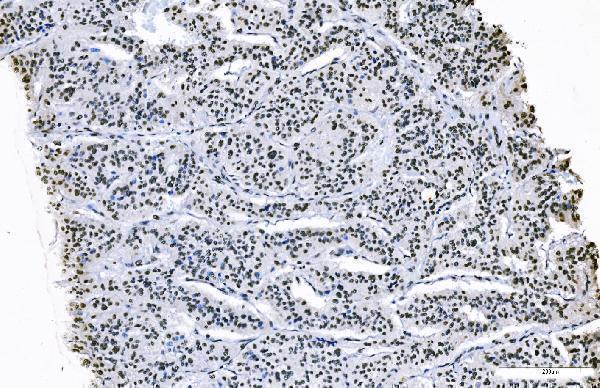 a07015 2 foxk1 primary antibodies ihc testing 8