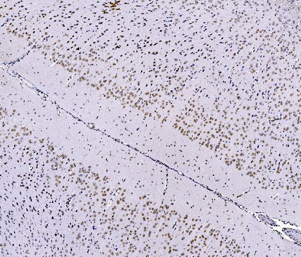 a07015 2 foxk1 primary antibodies ihc testing 9