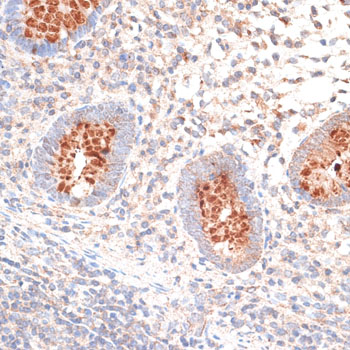 Immunohistochemistry of paraffin-embedded human appendix using KIR3DL3 antibody  at dilution of 1:100 