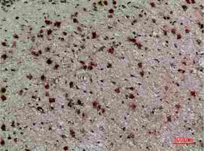 Immunohistochemistry (IHC) analysis of paraffin-embedded Human Brain, antibody was diluted at 1:100