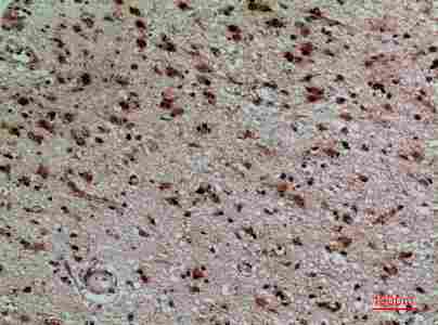 Immunohistochemistry (IHC) analysis of paraffin-embedded Human Brain, antibody was diluted at 1:100