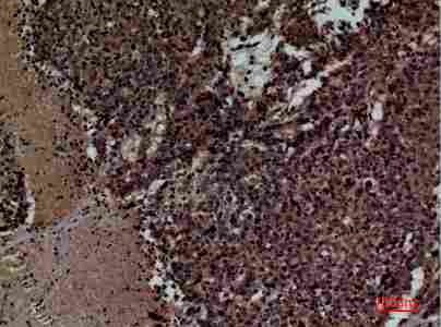 a07017 kir3dl3 primary antibodyes ihc testing 4