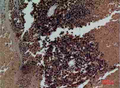 a07017 kir3dl3 primary antibodyes ihc testing 5