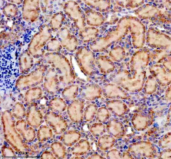 IHC analysis of PELO using anti-PELO antibody (A07018)