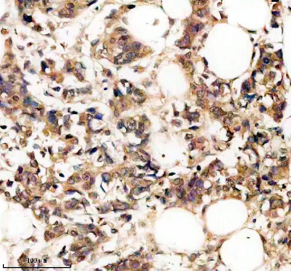 IHC analysis of PELO using anti-PELO antibody (A07018)