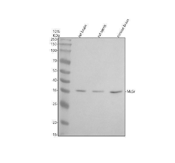 Western blot analysis of MC5R using anti-MC5R antibody (A07019-3)