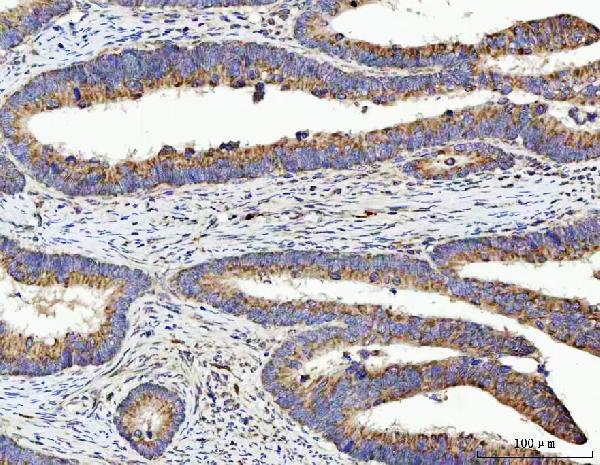  IHC analysis of TSEN54 using anti-TSEN54 antibody (A07022-2)